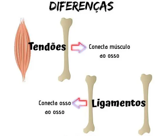 Diferenças entre Tendões e Ligamentos