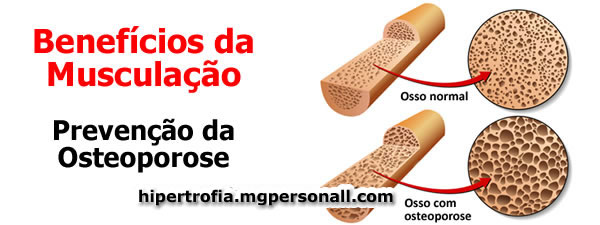 Benefícios da Musculação - Prevenção da Osteoporose