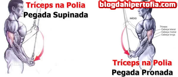 tríceps na polia com pegada pronada e supinada