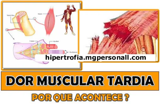 Dor Muscular Tardia - Por que sinto dores após o Treino?